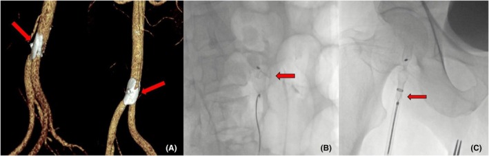 FIGURE 3