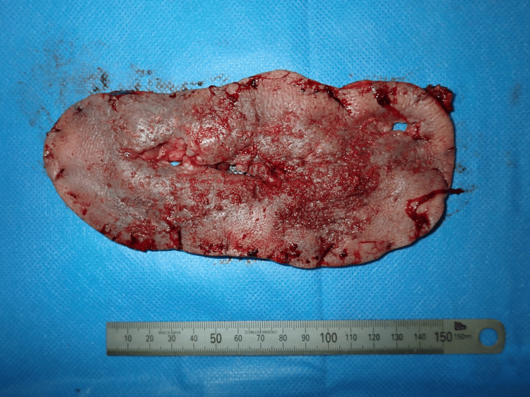 Figure 14
