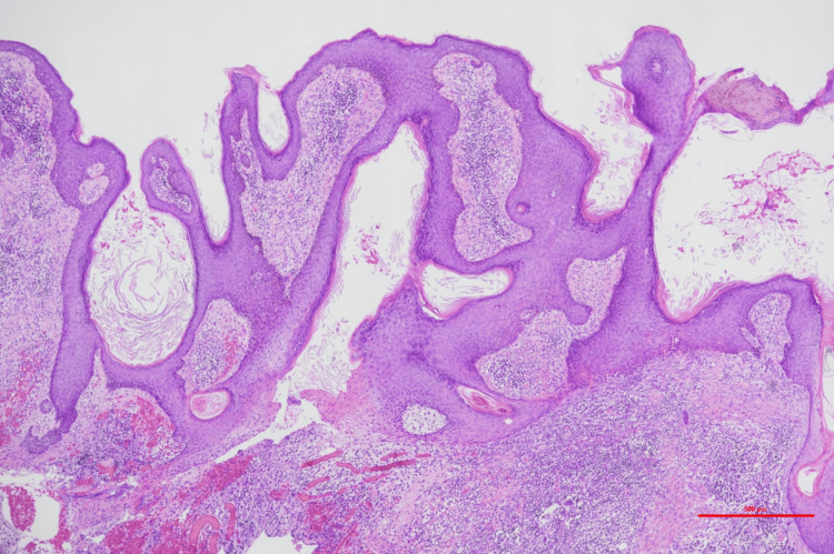 Figure 17