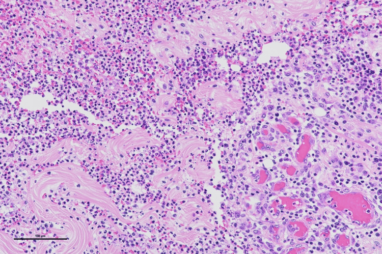 Figure 18