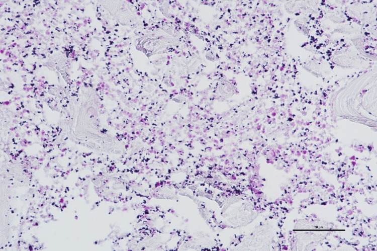 Figure 19