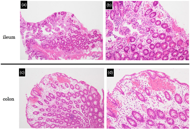 FIGURE 3
