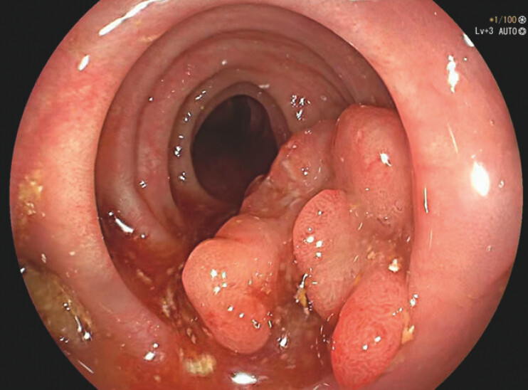 Fig. 1