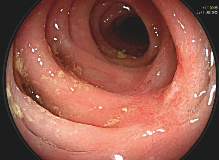 Fig. 3
