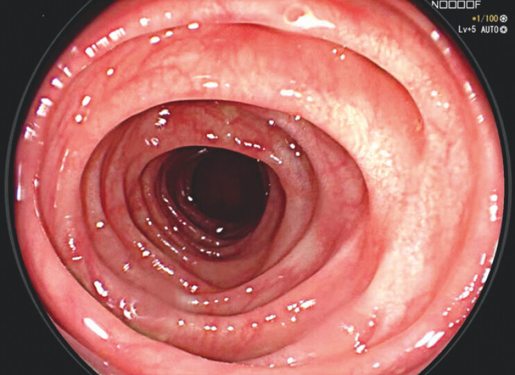 Fig. 4