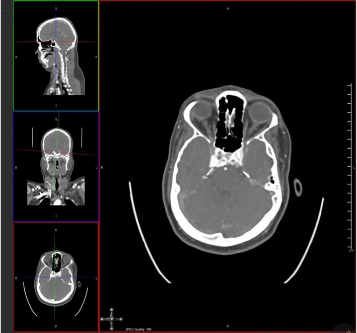 FIGURE 2
