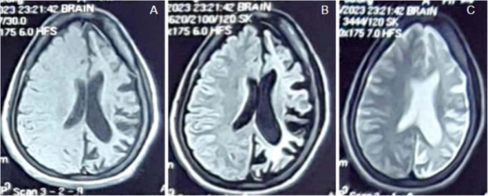 FIGURE 2