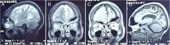 FIGURE 3