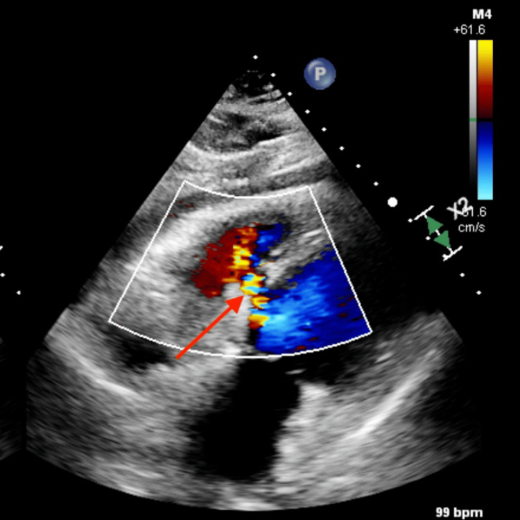 Figure 5
