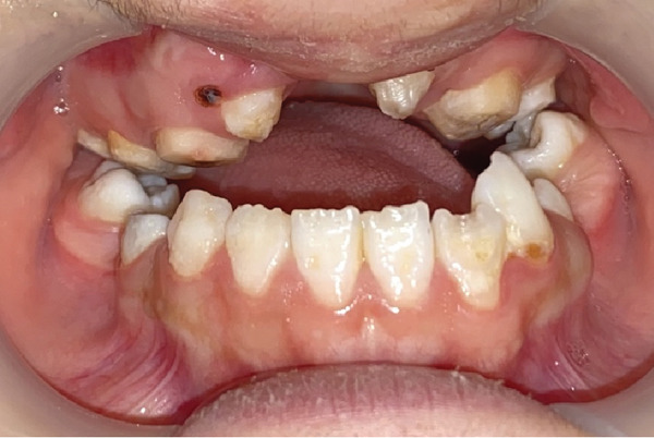 Figure 6