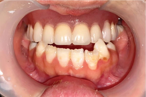 Figure 10