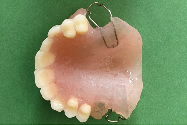 Figure 9