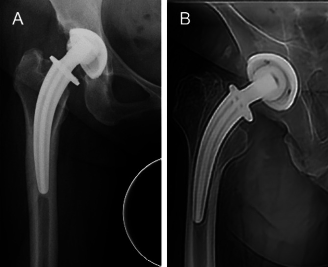 FIGURE 3