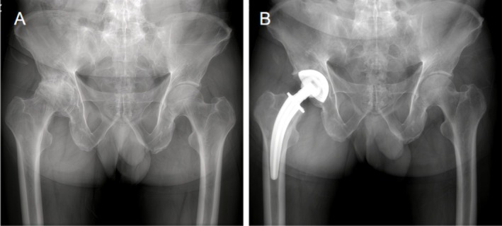FIGURE 1