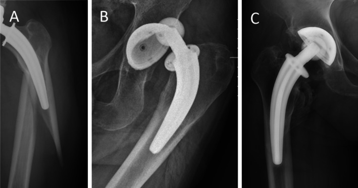 FIGURE 4