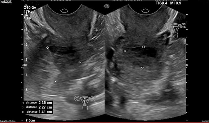 Figure 1