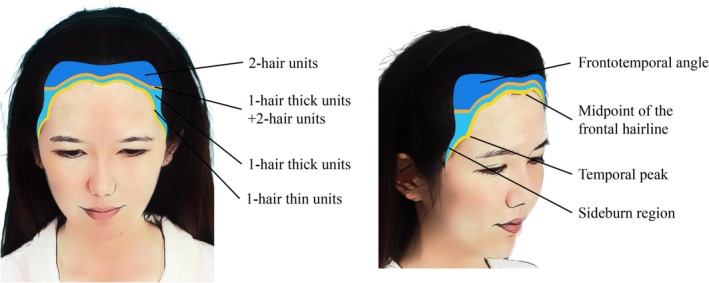 FIGURE 2