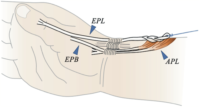 Figure 9