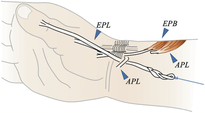 Figure 11
