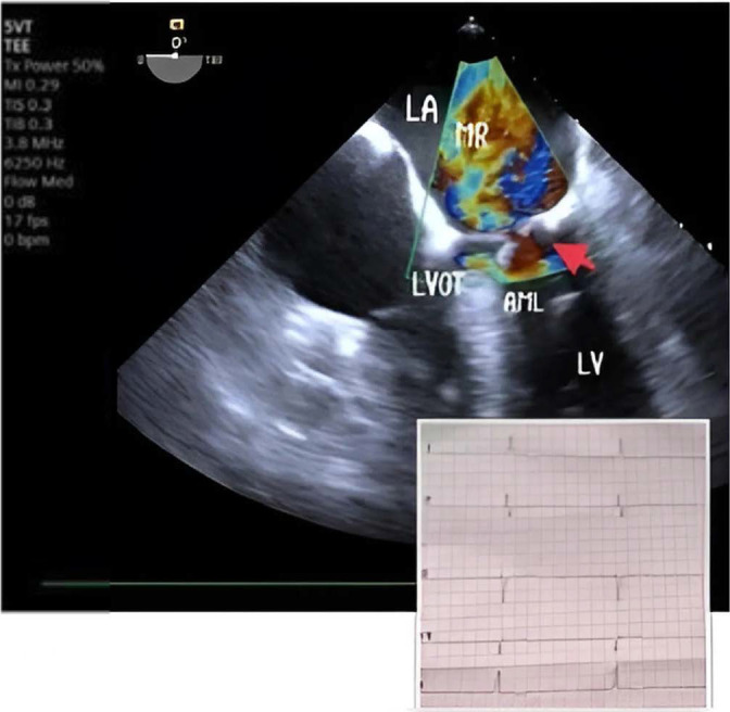 Fig. 2