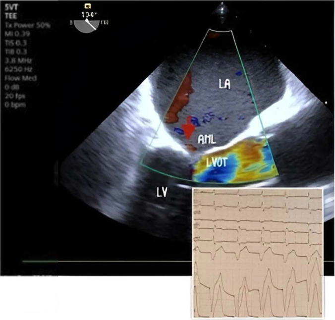 Fig. 3