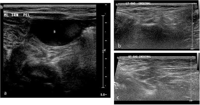 Figure 2
