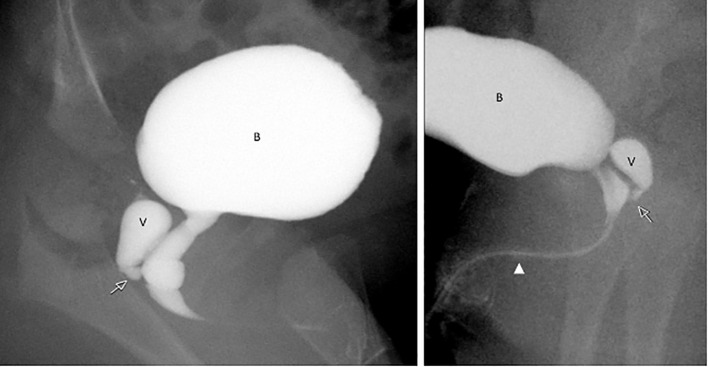 Figure 3