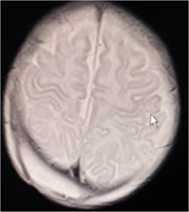 FIGURE 1