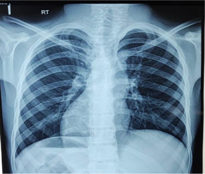 FIGURE 1