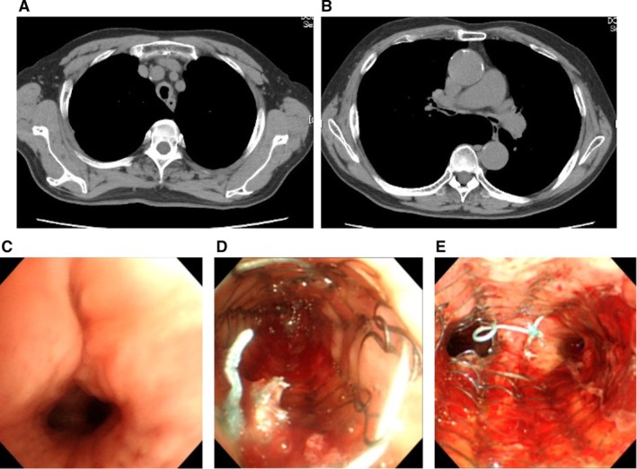 FIGURE 2