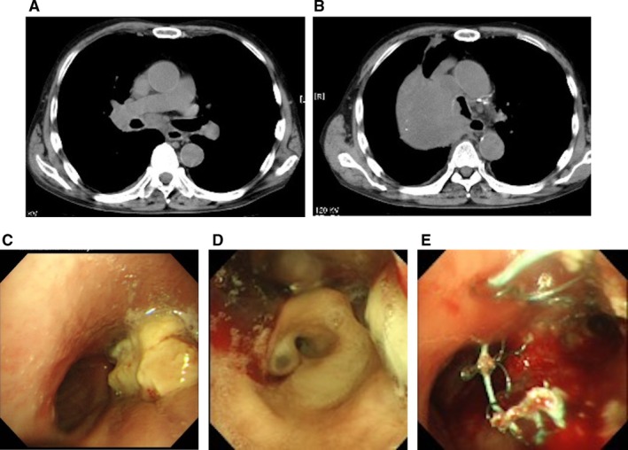 FIGURE 1