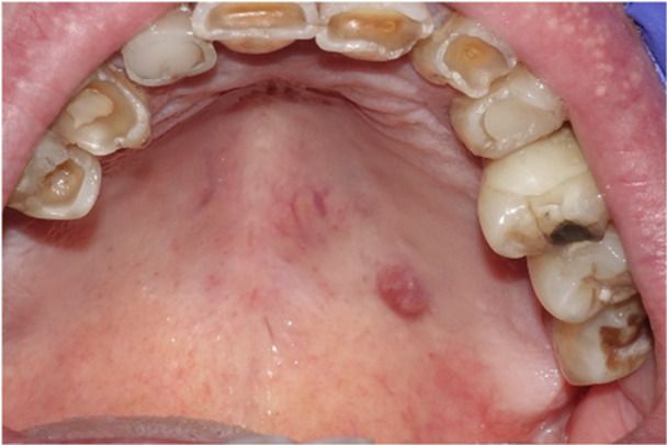 Figure 12