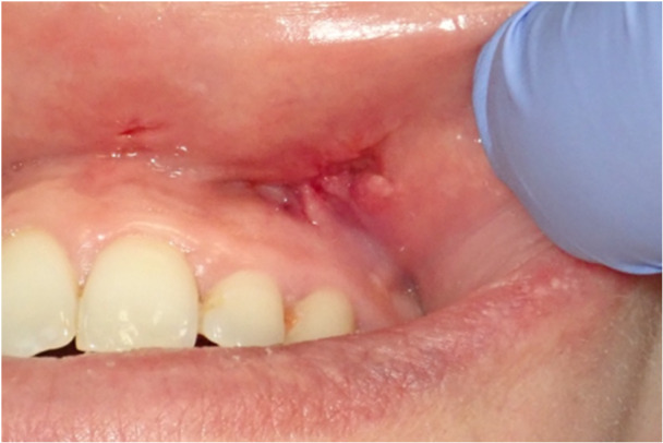 Figure 13