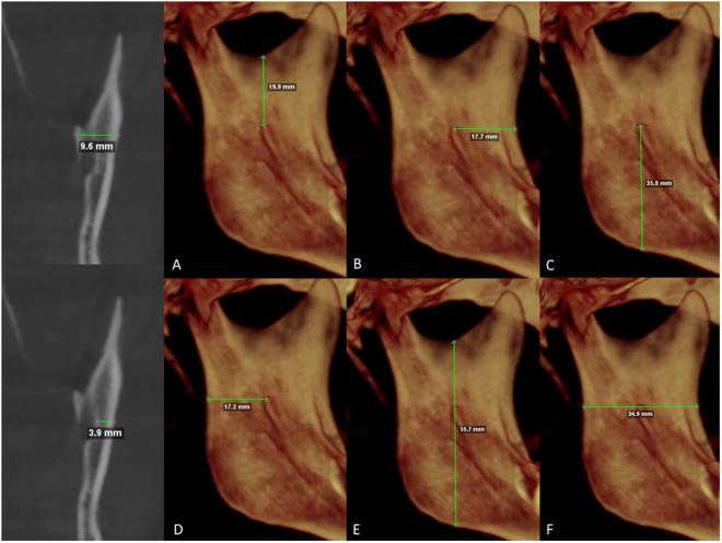 Fig 2