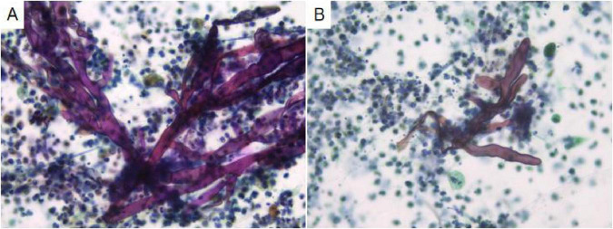 FIGURE 3