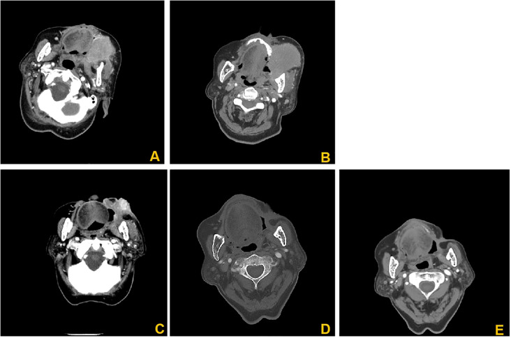 Figure 2