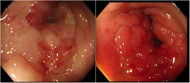 Figure 3