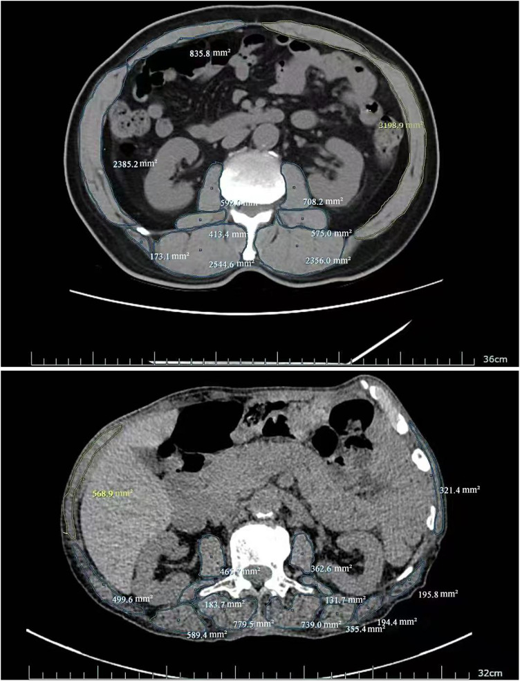 Figure 2