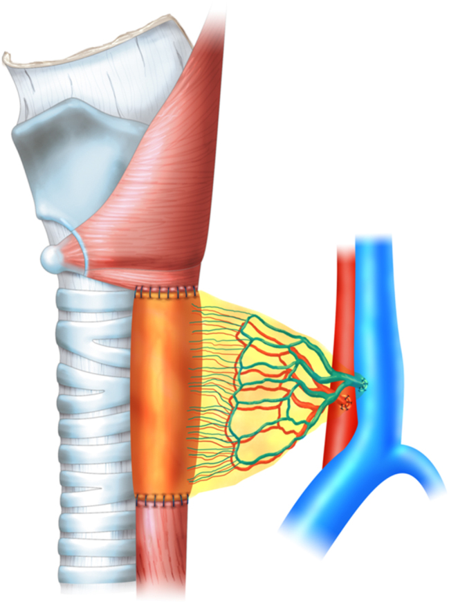 Figure 2
