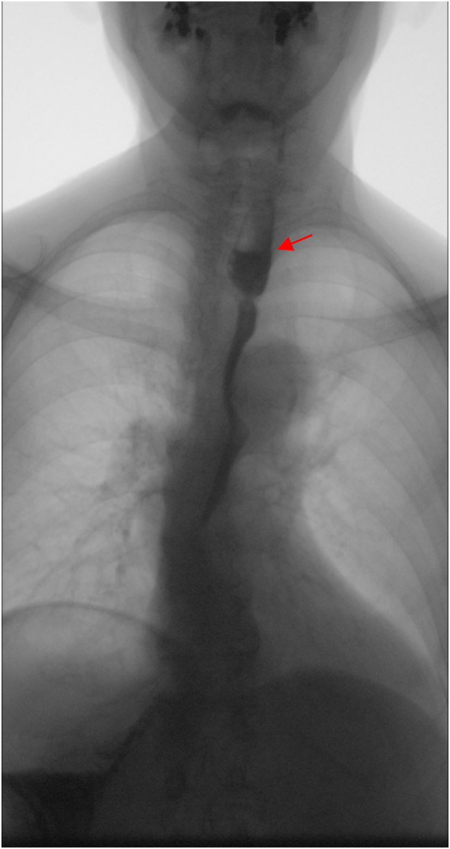 Figure 3