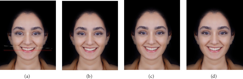 Figure 4