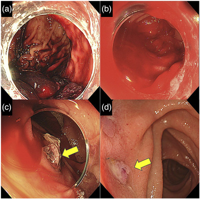 FIGURE 2