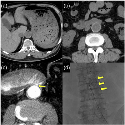FIGURE 1
