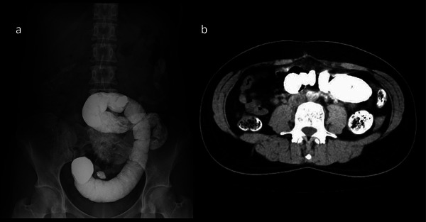 FIGURE 1