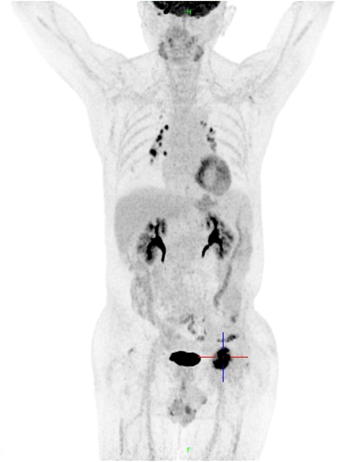Figure 2