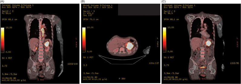 Figure 1