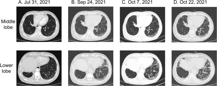 Figure 2