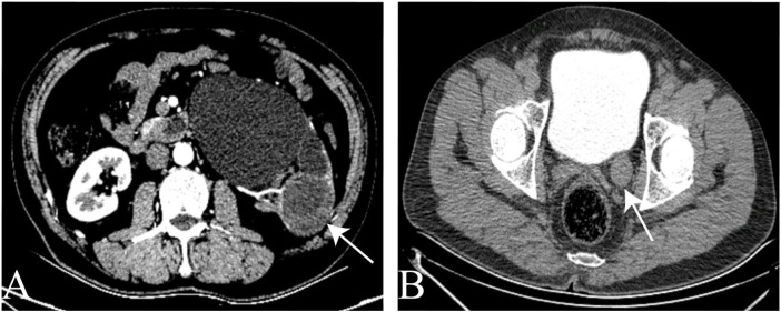 Figure 1