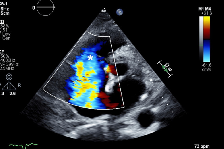 Figure 4