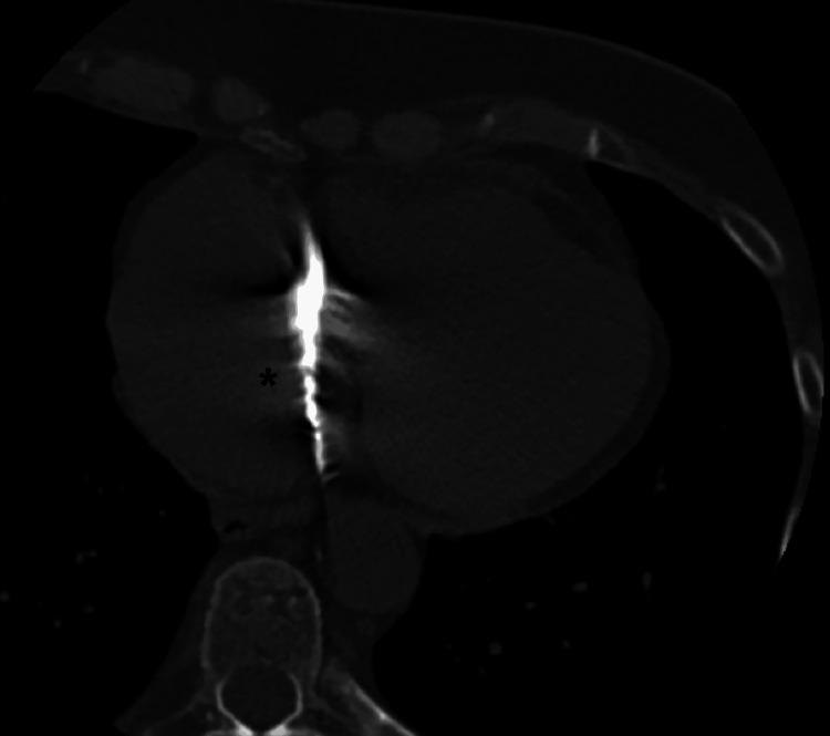 Figure 7